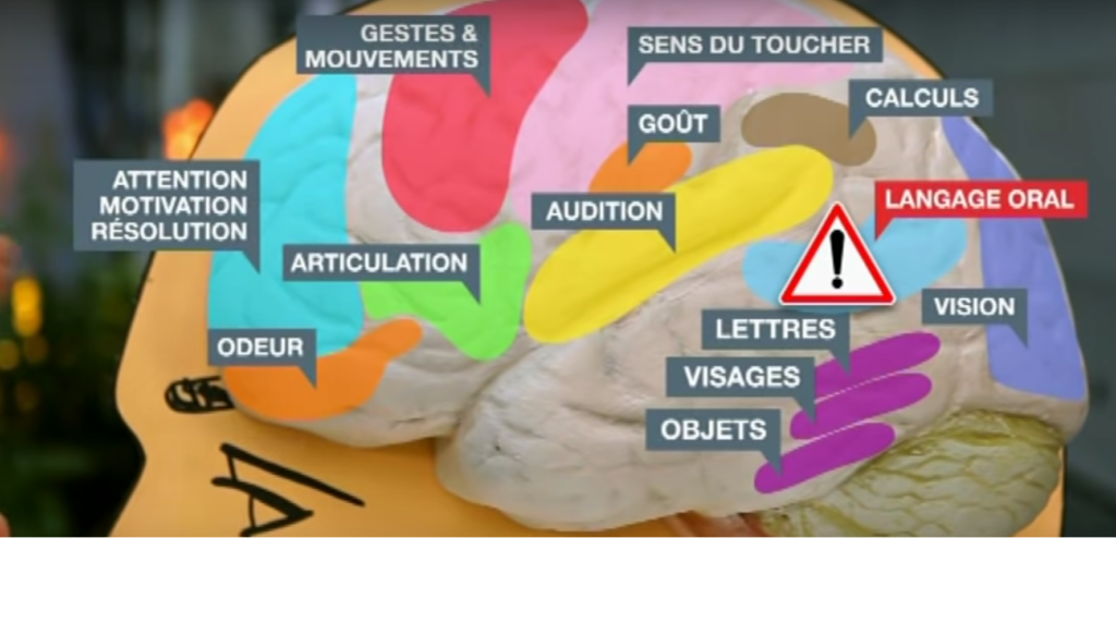 les fonctions du cerveau troubles dys